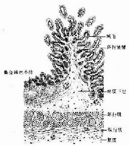 先天性十二指肠闭锁 先天性十二指肠闭锁