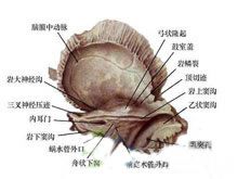 骨巨细胞瘤